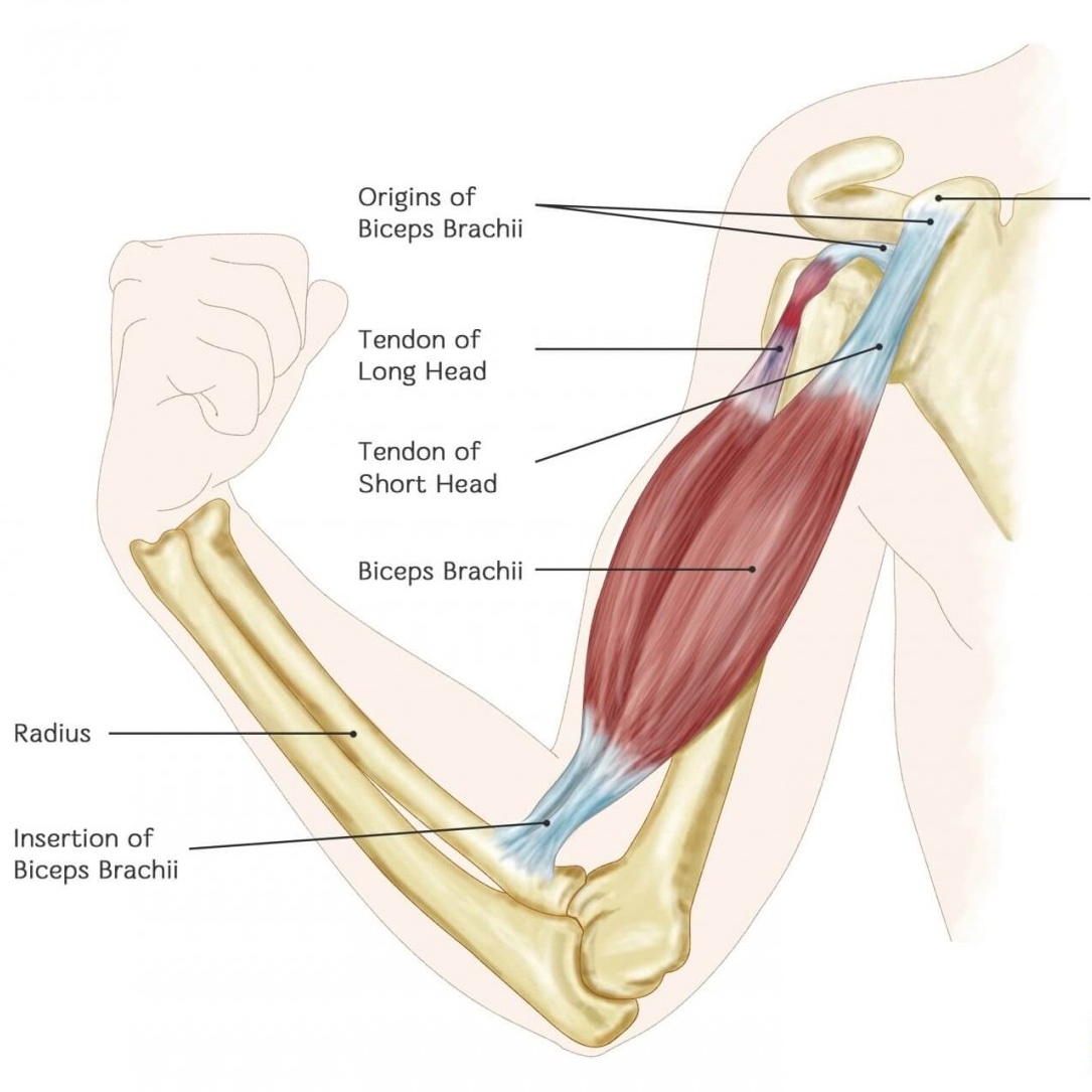 Anatomical diagram of the long head of the biceps tendon showing bicipital tendinopathy.