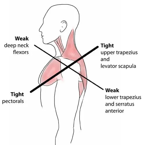 Diagram showing the impact of forward head posture and cervical spine loading during desk work