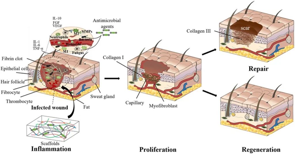 tissue healing phases, fibrin scaffold, inflammation, proliferation, regeneration