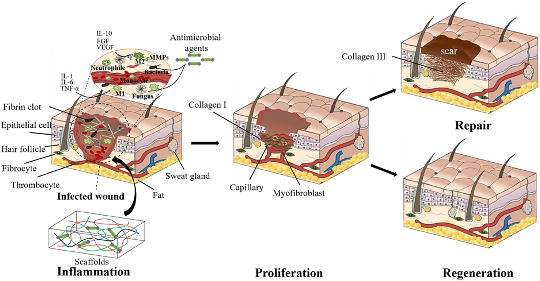 tissue-healing-phases-inflammation-proliferation-regeneration - Square One Active Recovery tissue healing phases, fibrin scaffold, inflammation, proliferation, regeneration