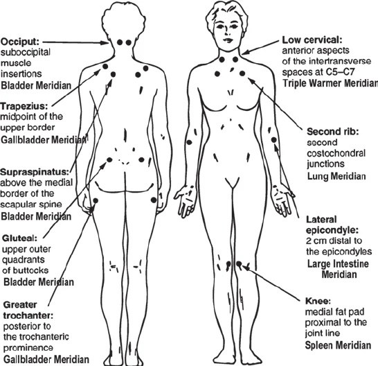 A Square One specialist conducting a movement assessment for a fibromyalgia patient to improve nervous system regulation and functional capacity.