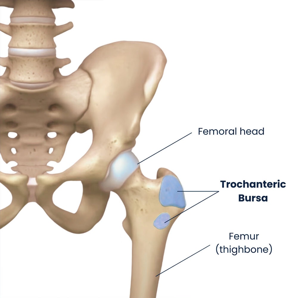 Lateral hip anatomy diagram showing the bursa and greater trochanter for pain management