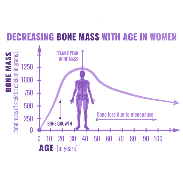 A line graph illustrating the rapid decline in bone mineral density (BMD) in women following the onset of menopause due to estrogen reduction.