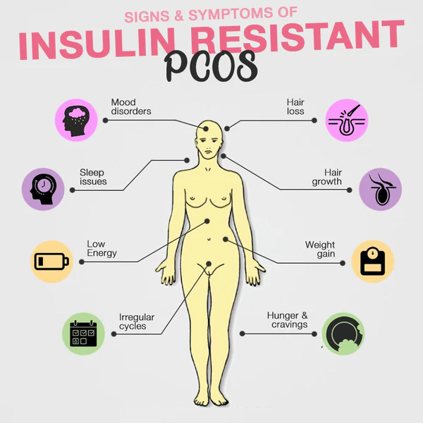 An educational infographic listing the common signs and symptoms of PCOS, including its clinical link to insulin resistance and metabolic health.