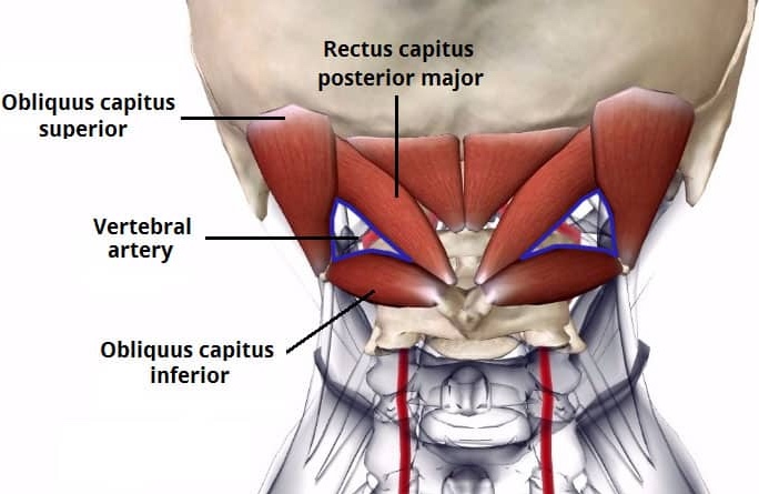 Anatomy diagram of the suboccipital muscles at the base of the skull, a common mechanical driver for cervicogenic headaches