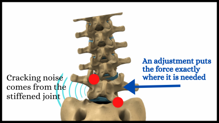 Visual breakdown of a chiropractic spinal adjustment, highlighting how precise mechanical force interacts with the vertebral column and surrounding joint capsules.