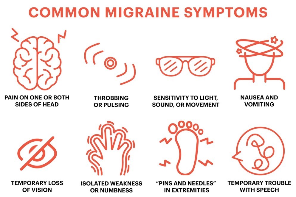 Medical infographic illustration detailing common migraine symptoms including pain on one or both sides of the head, throbbing or pulsing, sensitivity to light and sound, nausea, temporary loss of vision, isolated numbness, pins and needles in extremities, and temporary trouble with speech.